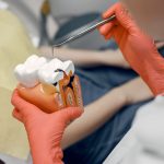 root canal therapy near you
